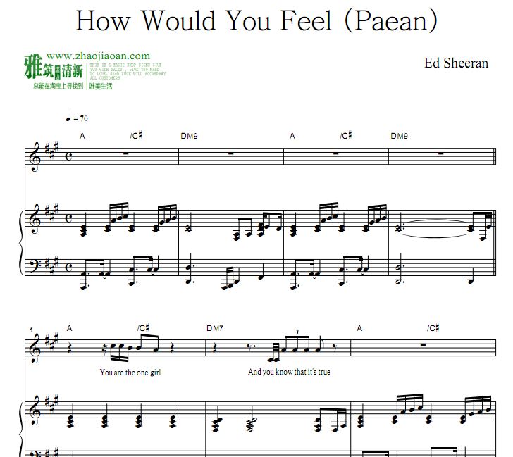 Ed Sheeran - How Would You Feelٵ