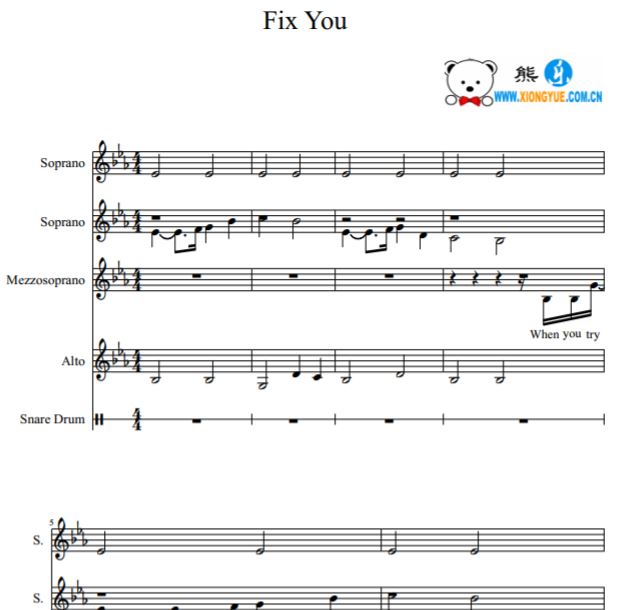 Fix You SSMA���������ϳ���+�İ�����