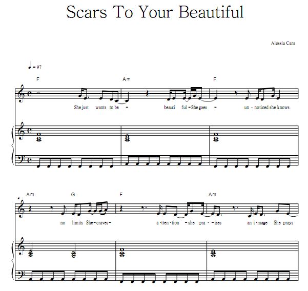 Alessia Cara - Scars To Your Beautiful ٵ