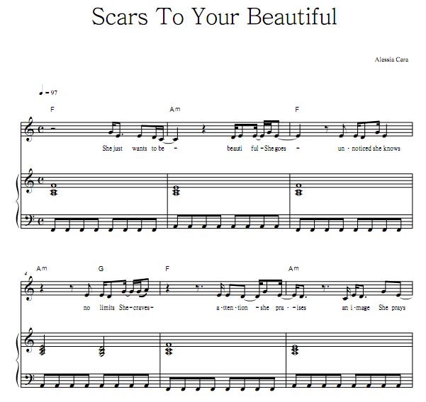 Alessia Cara - Scars To Your Beautiful ���ٵ�����