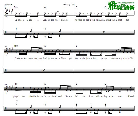 Ed Sheeran - Galway Girl ʿ