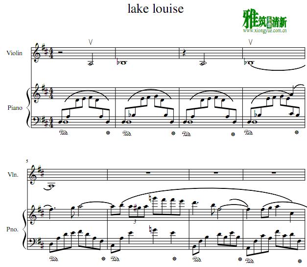 ֱԣLake LouiseСٸ3