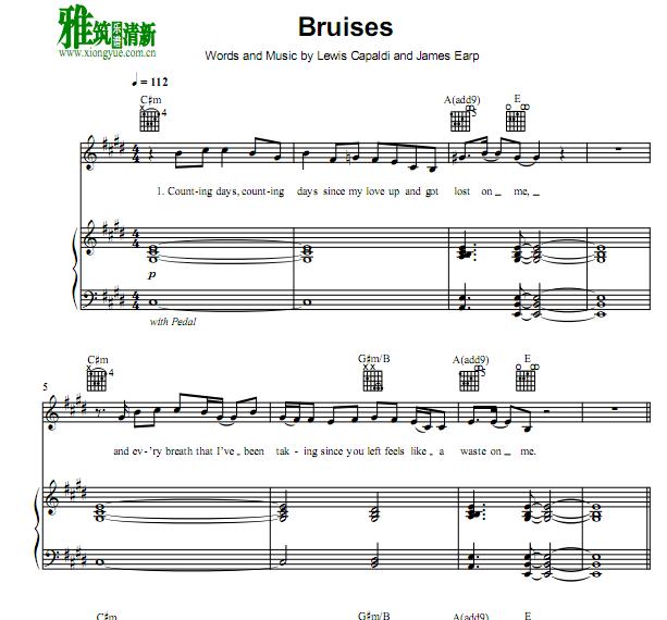 Lewis Capaldi - bruises  ٰ